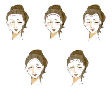 《額頭個性診斷》髮際線的模樣會透露出什麼呢？