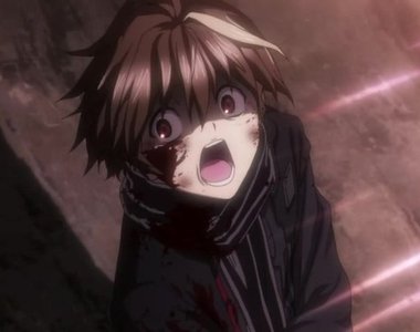 《動漫角色老是斷手？》正所謂打斷手骨顛倒勇