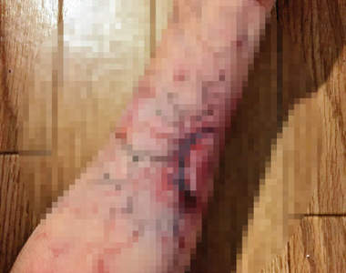 閱覽注意《被陌生人咬到的結果》驚悚推文難道是活屍病毒的擴散！？