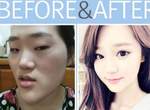 史上最強《整形照特輯》這真的是同一個人嗎？