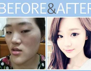 史上最強《整形照特輯》這真的是同一個人嗎？