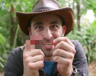 流血注意《切葉蟻咬手指》牙齒好像很利那來給他咬咬看好了(?)