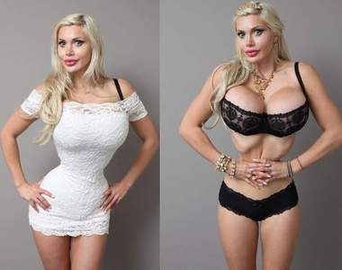 J罩杯《美女子拔肋骨整眼球》因為她想變成動漫人物…