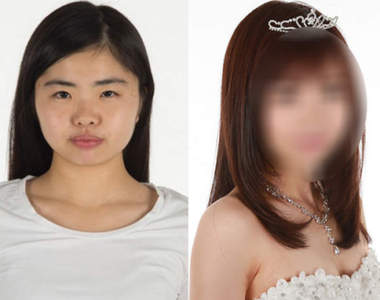 日本舉辦《整形選美大賽》參賽者術後究竟會有多大的變化？