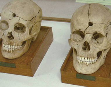 【閱覽注意】泰國《死亡博物館》沉睡著所有奇異的標本