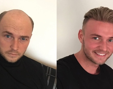 《極逼真禿頭用假髮》自從頭上有了毛~帥氣度+999呢