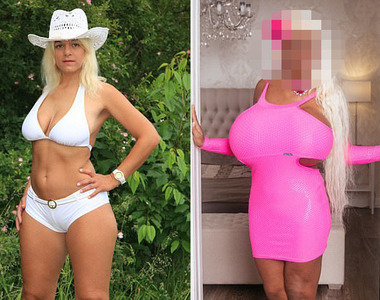 整形上癮《歐洲第一巨乳》比S罩杯還要驚人的改變是.....