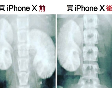 果粉不要看《一般網友對新哀鳳反應》奇怪腎怎麼少了一顆?