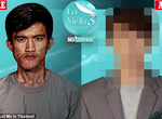 泰國歪臉男《整形整到媽媽都認不出來》可是媽媽感動到哭了... 泰國歪臉男《整形整到媽媽都認不出來》可是媽媽感動到哭了...