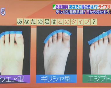 推特話題《從腳型選適合的鞋子》你的腳趾是羅馬、希臘還是埃及型?