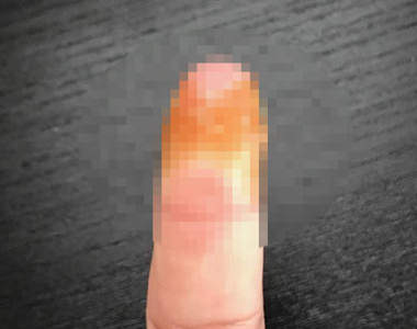 《指尖的OK繃貼法》難固定的部位也能讓OK繃完全貼合啦～