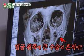 小時候跟別人打架《結果埋藏10幾年的秘密被發現》連老媽都不知道....