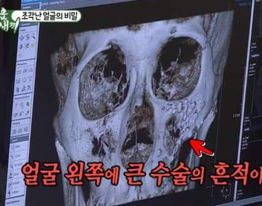 小時候跟別人打架《結果埋藏10幾年的秘密被發現》連老媽都不知道....