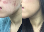 女子摔角選手《夏すみれ的鐵壁畫妝術》被揍也要美美的…… 女子摔角選手《夏すみれ的鐵壁畫妝術》被揍也要美美的……