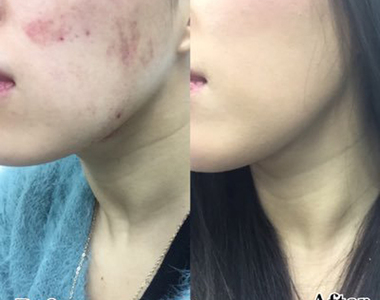 女子摔角選手《夏すみれ的鐵壁畫妝術》被揍也要美美的……