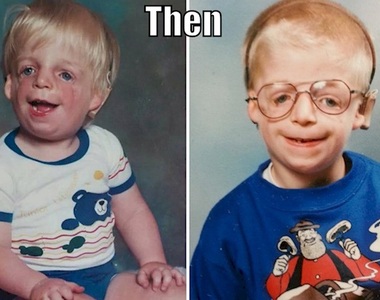  勵志《因遺傳疾病被拋棄的孩子》即使爸媽拒絕見面也沒被擊倒