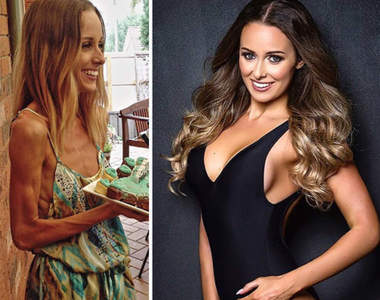 《厭食者的健康對比照》重生後超美的阿～