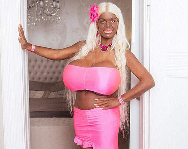 《S杯白人模特兒》臉書宣布自己成功整形成黑人了......