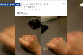 校園暴力再現《打完人之後上傳打到受傷的拳頭》還得意洋洋的自拍 校園暴力再現《打完人之後上傳打到受傷的拳頭》還得意洋洋的自拍
