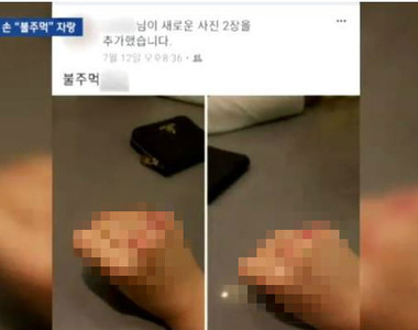 校園暴力再現《打完人之後上傳打到受傷的拳頭》還得意洋洋的自拍