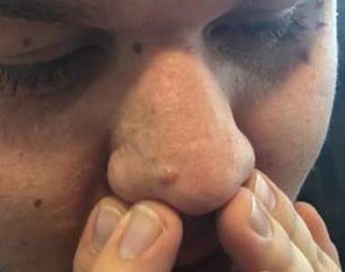 【閱覽注意】《異常療癒的清粉刺畫面》這也算是爆漿級享受吧......