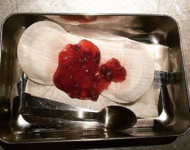 保險套、衛生棉全上桌《監獄醫院餐廳的18禁料理》讓你食慾全失（嘔）