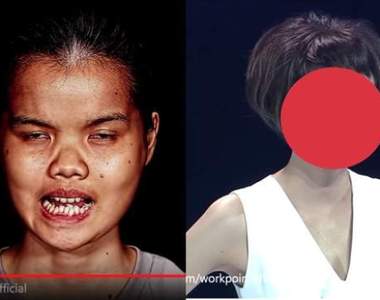 《Let Me In Thailand》泰國整形節目把女孩改頭換面實在有夠神