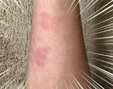 《貓肉球印事件簿》一覺醒來身上就多了這些愛的印記(〃∀〃)