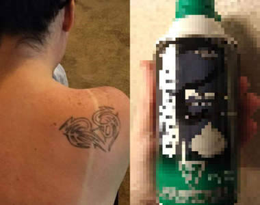 地方媽媽超神《曬傷療法》用一個東西就可以在30分鐘內舒緩刺痛感