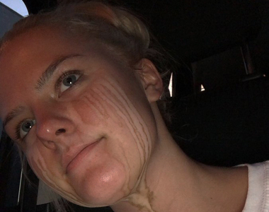 《上助曬劑後不能哭》哭出來的下場就是這樣......