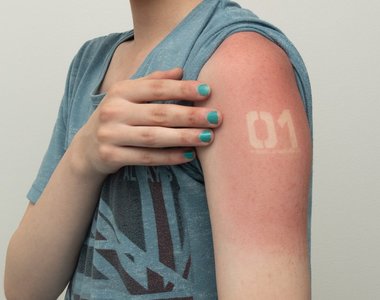 初音未來COSER示範《豔陽天沒有防曬的下場》去年的教訓只記得一半……