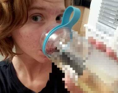 尿療風潮再起《喝尿治痘痘》從喝尿的那天起我整個人都不一樣了呢