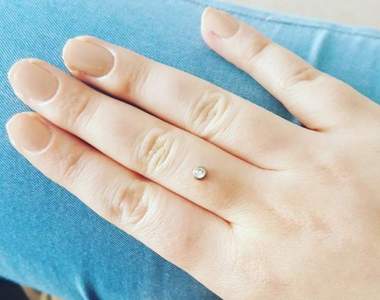 【閱覽注意】年輕人瘋《把鑽石嵌入手指》把鑽戒變成鑽指的新流行疼痛發燒中......