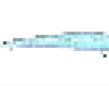 亞馬遜傳說《鑽入陰莖的寄生鯰》被寄生後沒好好處理可能要切GG...