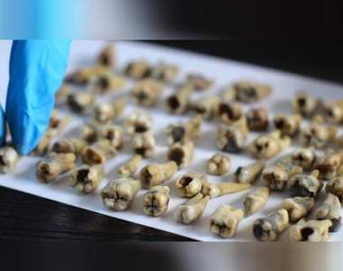 《從牆裡挖出1000顆人類牙齒》這可能是今年最不缺鈣的毛骨悚然新發現