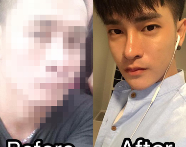 《長太醜找不到工作》泰國男子就把自己整成韓風男星臉