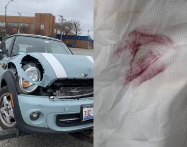 根本用生命在安利《車禍口紅照》這場車禍讓一支口紅和一位女孩紅了