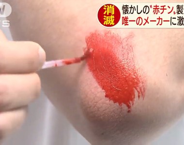 《紅藥水絕跡》懷舊藥水走入歷史老一輩直呼超可惜 為什麼年輕人都不愛用……