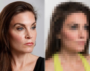 因為《面無表情臉看起來太兇》選擇整形 整完後真的有變比較和善嗎?