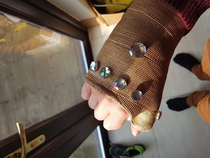 網友把石膏變成《無限手套》既然都受傷了不如自娛娛人一下嘛～ - 圖片4