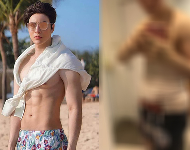 《靠整形擁有六塊肌》以後想要大肌肌 靠苦練跟靠忍痛選一個吧...