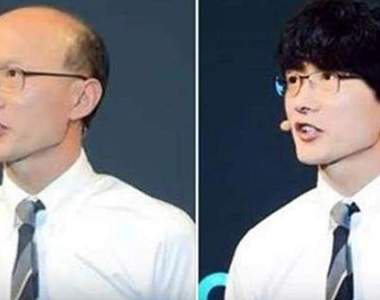 《男友禿頭讓女友想分手》是女友太現實還是有些不得不考慮的因素?