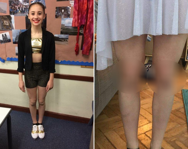 恐怖錯覺圖《膝蓋有兩張臉(゚Д゚≡゚Д゚)》雖然知道是錯覺還是嚇死我了