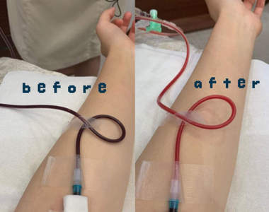 日本藝人瘋《臭氧血療法》號稱能淨化血液的美容法,遭網友批根本義務教育失敗...