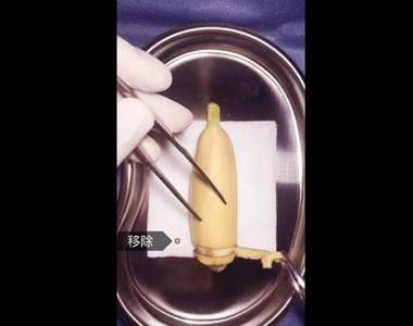 網路爆紅《給水果做手術》因為這「原因」讓醫生決定幫香蕉割包皮（欸）