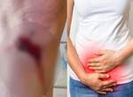 炎上推特《膝蓋擦傷 vs 經痛》男推主一句話讓女網友7pupu決定好好聊聊 炎上推特《膝蓋擦傷 vs 經痛》男推主一句話讓女網友7pupu決定好好聊聊