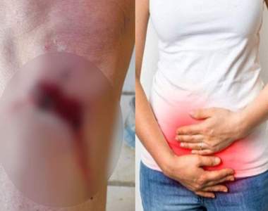 炎上推特《膝蓋擦傷 vs 經痛》男推主一句話讓女網友7pupu決定好好聊聊