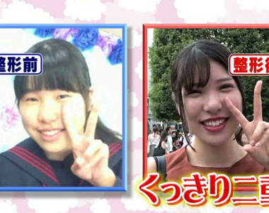 《年輕人公布整型風潮》承認整過型再也不丟臉？日本女生提出5大公開的理由……