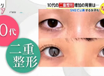 《國中生割雙眼皮議論》父母帶小孩整形爆增 早點解決自卑的外貌究竟好不好? 《國中生割雙眼皮議論》父母帶小孩整形爆增 早點解決自卑的外貌究竟好不好?