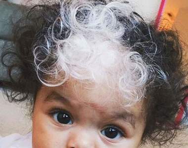 《有著非常特別遺傳基因的人們》大自然對生來與眾不同早就有了安排